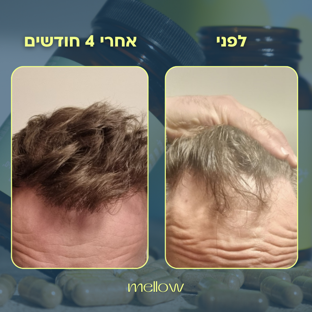 +Restore - לנשירה וחיזוק השיער לגבר